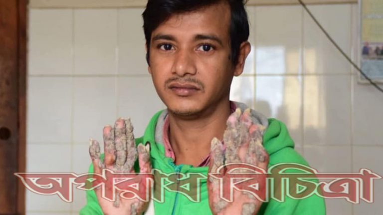 বাকলের মতো অংশগুলো আবার গজাতে শুরু করেছে