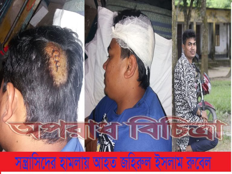 নাঙ্গলকোটে সন্ত্রাসী হামলায় ছাত্রলীগ নেতা আহত