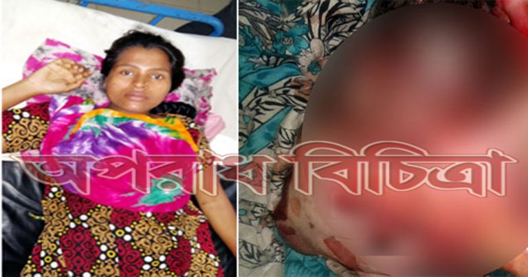 সিজার করতে গিয়ে প্রসূতির পেটে নবজাতকের মাথা কেটে বিচ্ছিন্ন