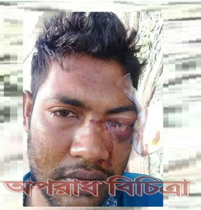 দালালের অত্যাচারে চোখ হারালো নোয়াখালীর বাহাদুর।