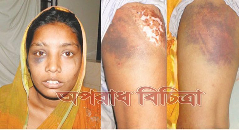 মাদকসেবী পাষন্ড স্বামীর নির্যাতনের শিকার বুলবুলি