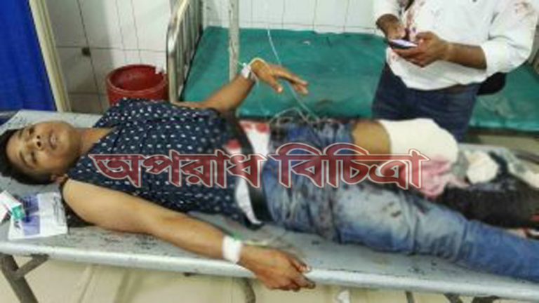 বাসচাপায় পা হারালেন প্রাইভেট কার চালক