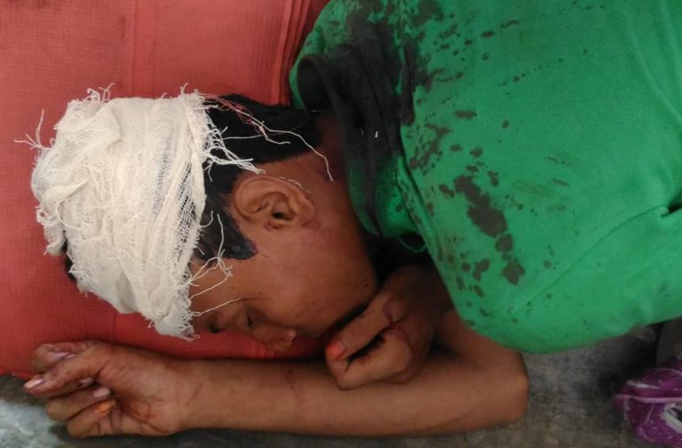 বাঘায় চলাচলের রাস্তা নিয়ে দু’পক্ষের সংঘর্ষে নারিসহ আহত-৮
