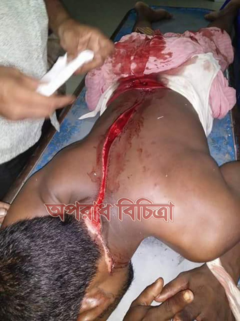 বেলকুচিতে পারিবারিক কলহের জের ধরে সংঘর্ষে ৩ সহোদর সহ ৬ জন আহত