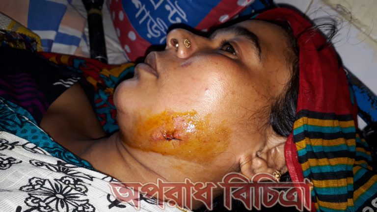 ৫০ হাজার টাকা চাঁদার দাবীতে রায়পুরে প্রবাসীর বাড়ীতে সন্ত্রাসী হামলা,মালামাল লুট, আহত তিন নারী