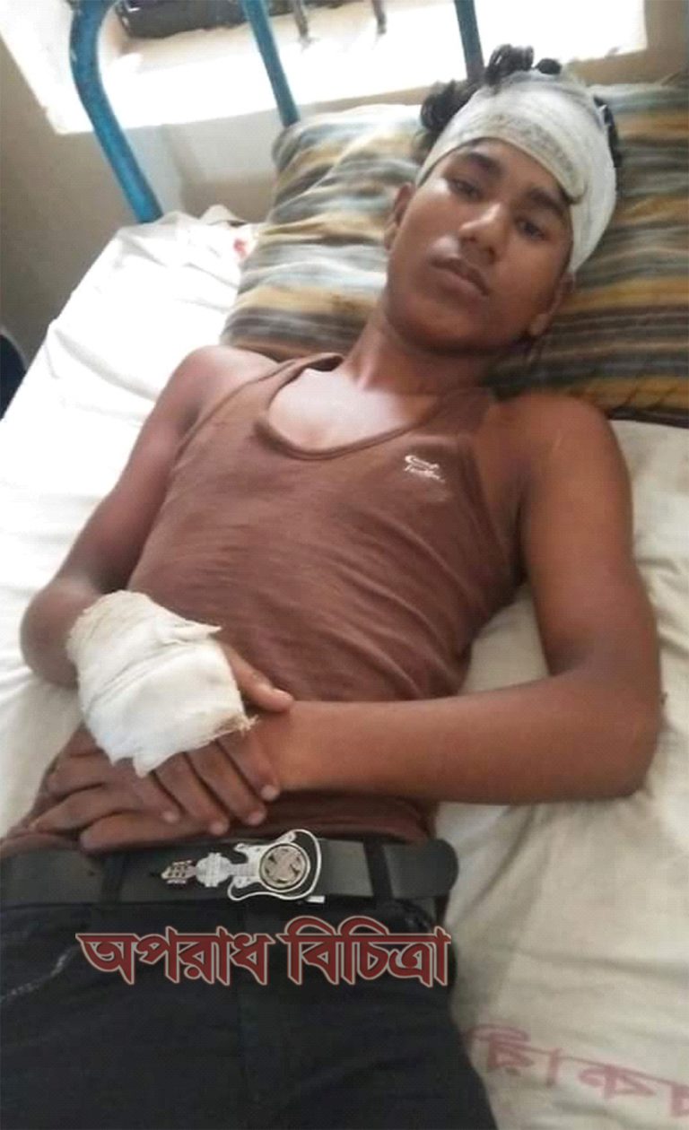 সেনবাগে পিকনিকের গাড়ীতে সন্ত্রাসী হামলা ৫ স্কুল ছাত্র আহত