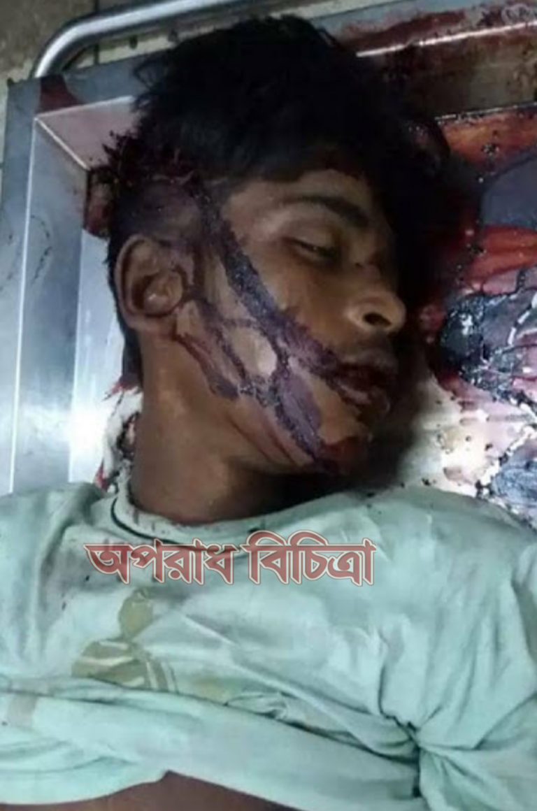 সোনারগাঁয়ে ৫ দিনেও মিলেনি অজ্ঞাতনামা ১ যুবকের লাশের পরিচয়