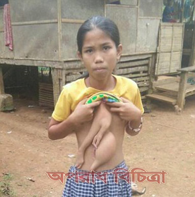 ভেরোনিকার জীবনে তাড়া করে ফিরছে এক শারিরীক সমস্যা