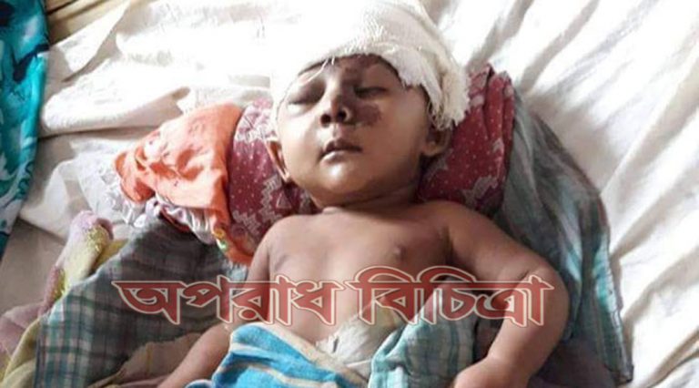 মারা গেল কুষ্টিয়ার সেই শিশুটি