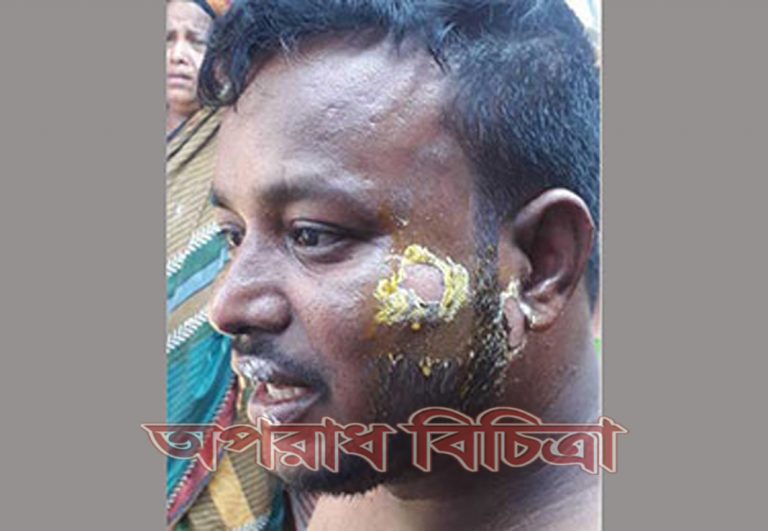 জুয়া খেলার প্রতিবাদ করায় এক যুবককে গরম পানি ঢেলে ঝলসে দিয়েছে জুয়াড়িরা
