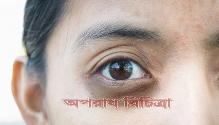 জেনে নিন যেভাবে চোখের নিচের কালো দাগ দূর করবেন