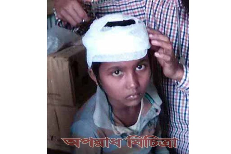 এক শিশু ছাত্রীর মাথা ফাটিয়ে দিয়েছেন শ্রেণি শিক্ষক শামীম আহসান
