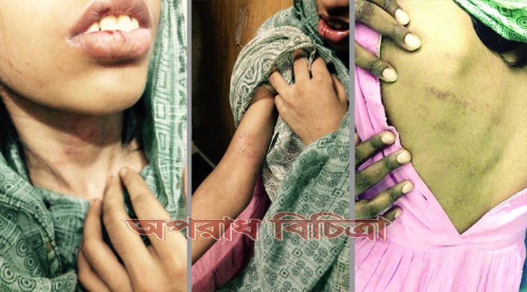 গৃহকর্ত্রী দ্বারা গৃহকর্মী অমানুষিক নির্যাতনের শিকার