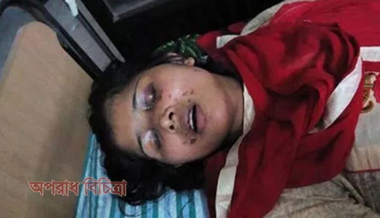 স্বামীর নির্যাতনে স্ত্রী অন্ধ