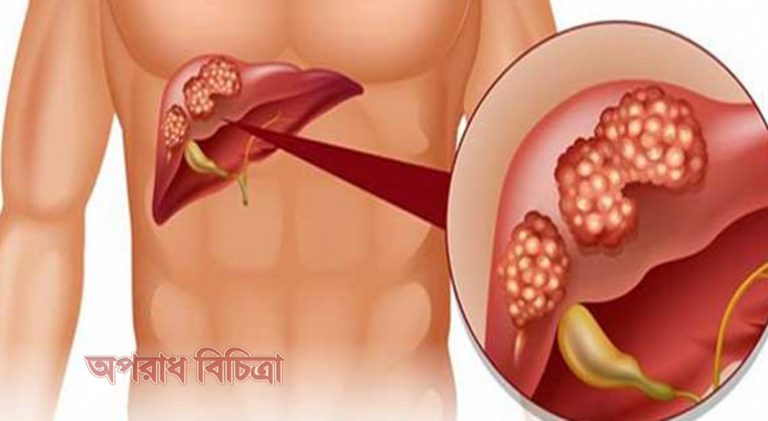 ক্যান্সারের যে ৫টি লক্ষণ পুরুষদের অগ্রাহ্য করা উচিত নয়