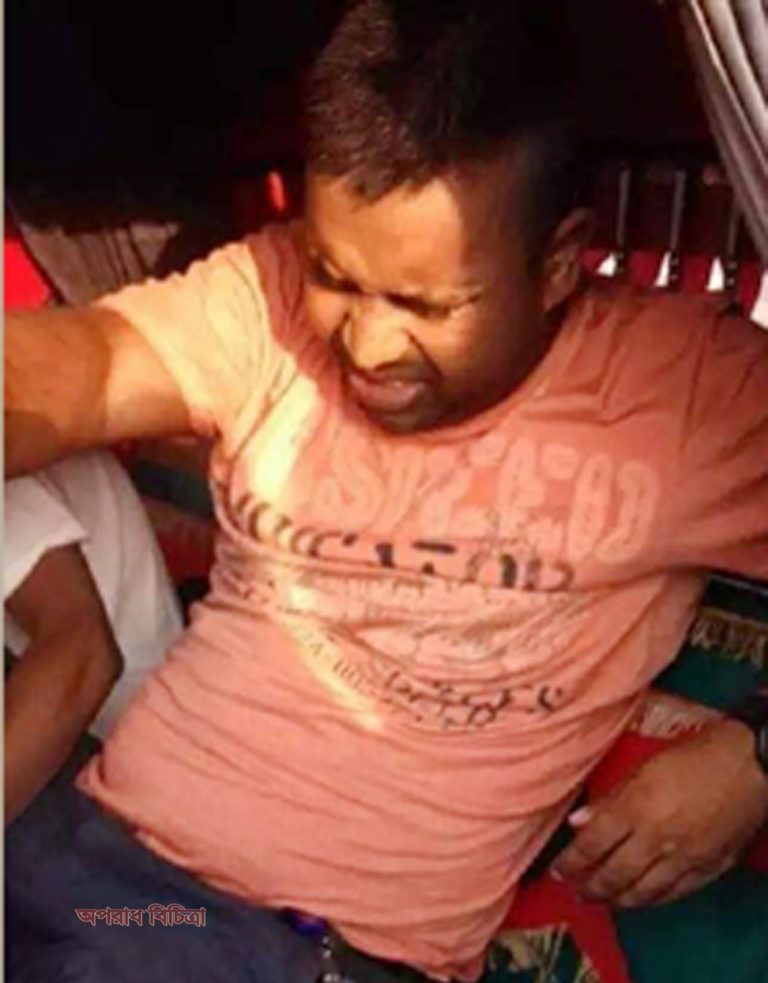 কনস্টেবল পারভেজের পা কেটে ফেলতে হচ্ছে