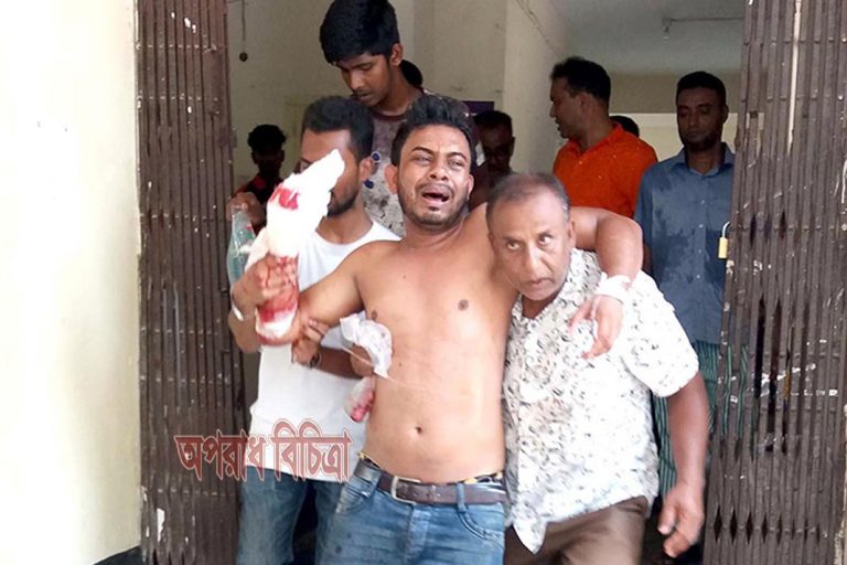 ব্যবসায়ীর চার আঙুল কেটে নিল ছাত্রলীগ নেতা