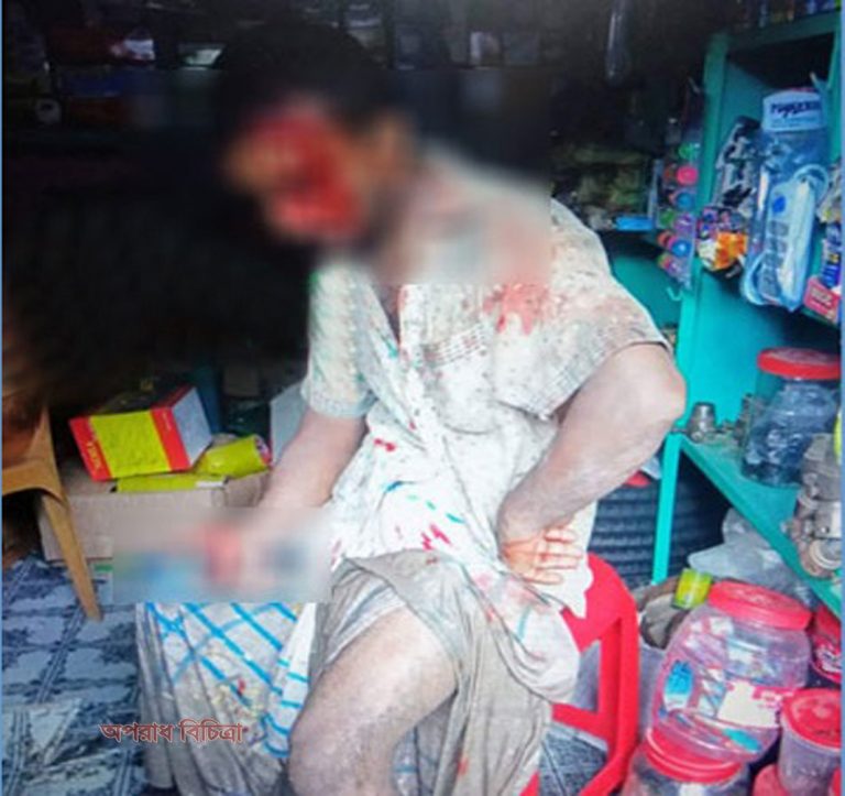 স্ত্রীর সামনে স্বামীকে কুপিয়ে জখম!