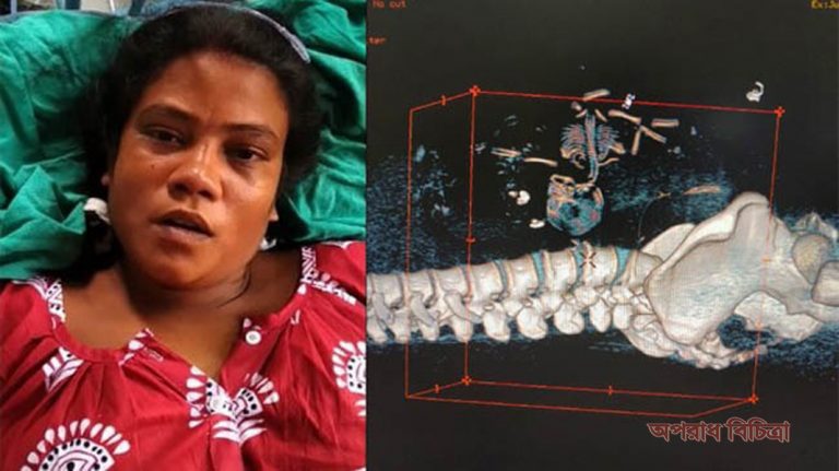 এমন ঘটনা বিস্ময়কর, বিরলের মধ্যে বিরলতম