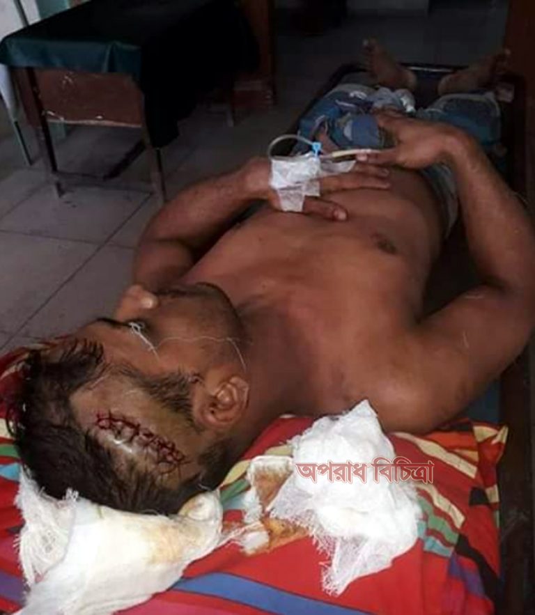 রূপসায় ঔষুধ কোম্পানির এমআর এর সাথে দোকান মালিকের সংঘর্ষ