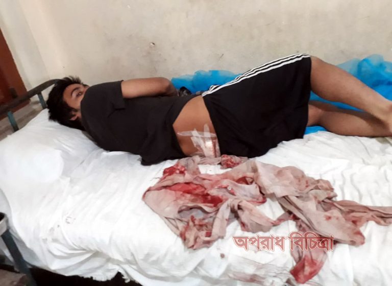 কাপ্তাই কেপিএম এলাকায় সন্ত্রাসিদের ছুরিকাঘাতে রাঙ্গুনিয়ার যুবক তাসিক হোসেন সিয়াম গুরুত্তর আহত