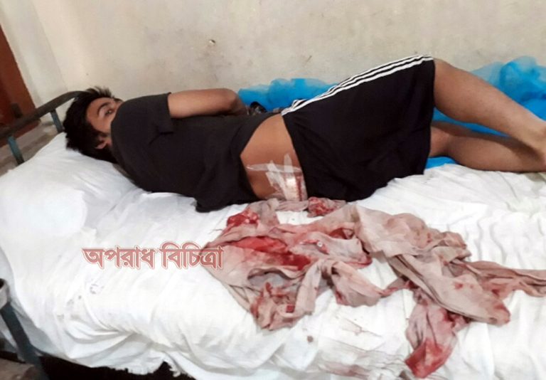 কাপ্তাই কেপিএম এলাকায় সন্ত্রাসিদের ছুরিকাঘাতে রাঙ্গুনিয়ার যুবক তাসিক হোসেন সিয়াম গুরুত্তর আহত