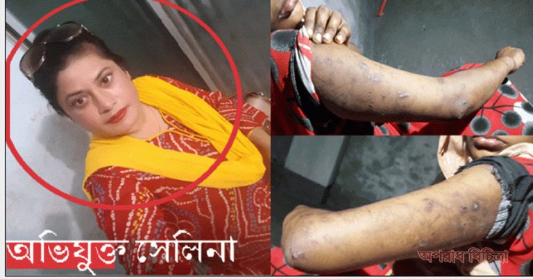 গৃহকর্তীর নির্মম নির্যাতনের খড়ক নেমেছে তার তারুণ্যে ভড়া শরীরে