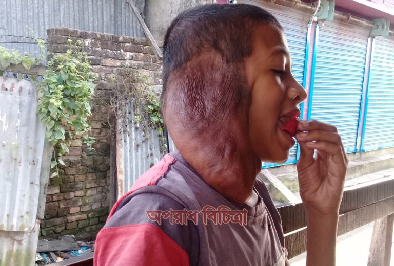 চিকিৎসার অভাবে বড় হচ্ছে শাহজালালের কান