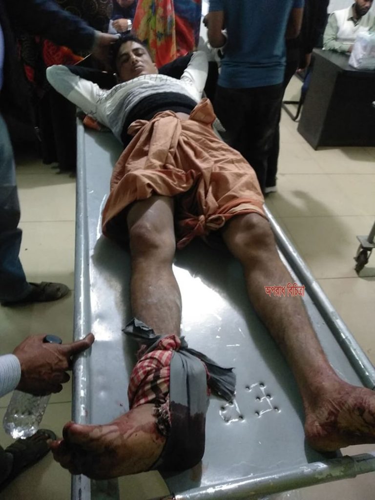শরিয়তপুরে যুবকের পায়ের রগ কর্তন
