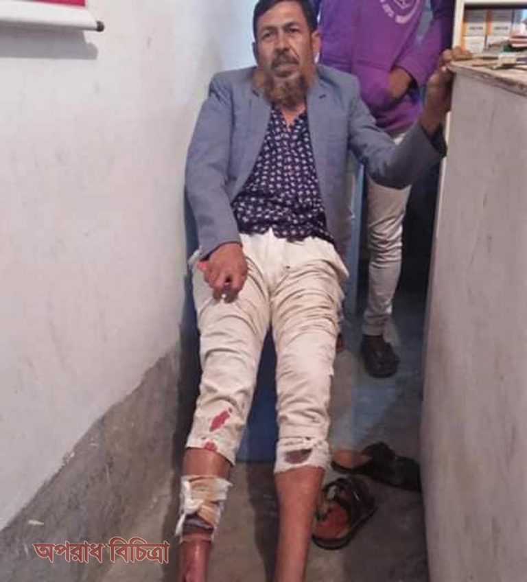 লাটিম মার্কা কাউন্সিলর প্রার্থীর উপর মফিজের ক্যাডার মঞ্জু বাহিনীর হামলা