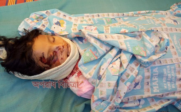 কুয়াকাটা-ঢাকা মহাসড়কে বাসের ধাক্কায় রাখাইন শিক্ষার্থীর মৃত্যু