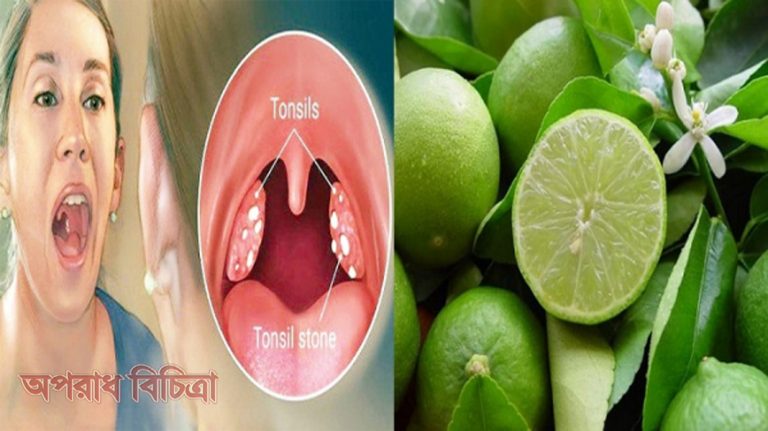 জেনে নিন টনসিলের ইনফেকশন সারাতে লেবুর উপকারিতা
