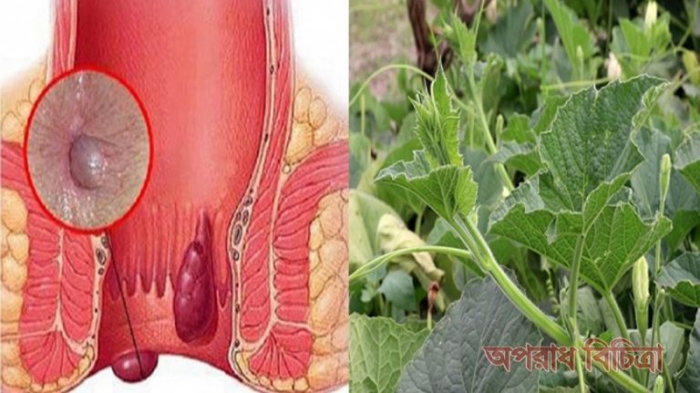 দেহের নানা রোগের হাত থেকে রক্ষা করে লাউ শাক