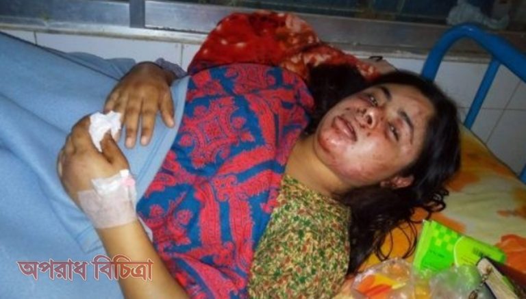 স্বামী কর্তৃক স্ত্রীকে অমানষিক নির্যাতন