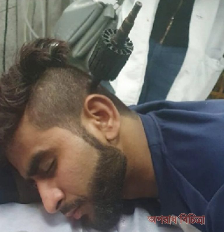 তরুণের মাথায় ঢুকিয়ে দেয়া হলো লোহার যন্ত্রাংশ