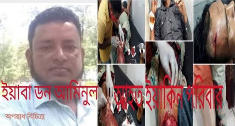 ইয়াকিনের পরিবারের উপর হামলাকারী ধরা ছোঁয়ার বাইরে-প্রশাসনের নিরব