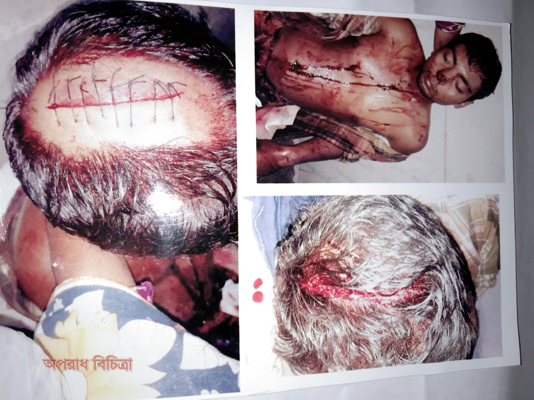 কিশোরগঞ্জেশামসুলগংএর হাতে সাজু ও তার পরিবারকে হত্যার চেষ্টা