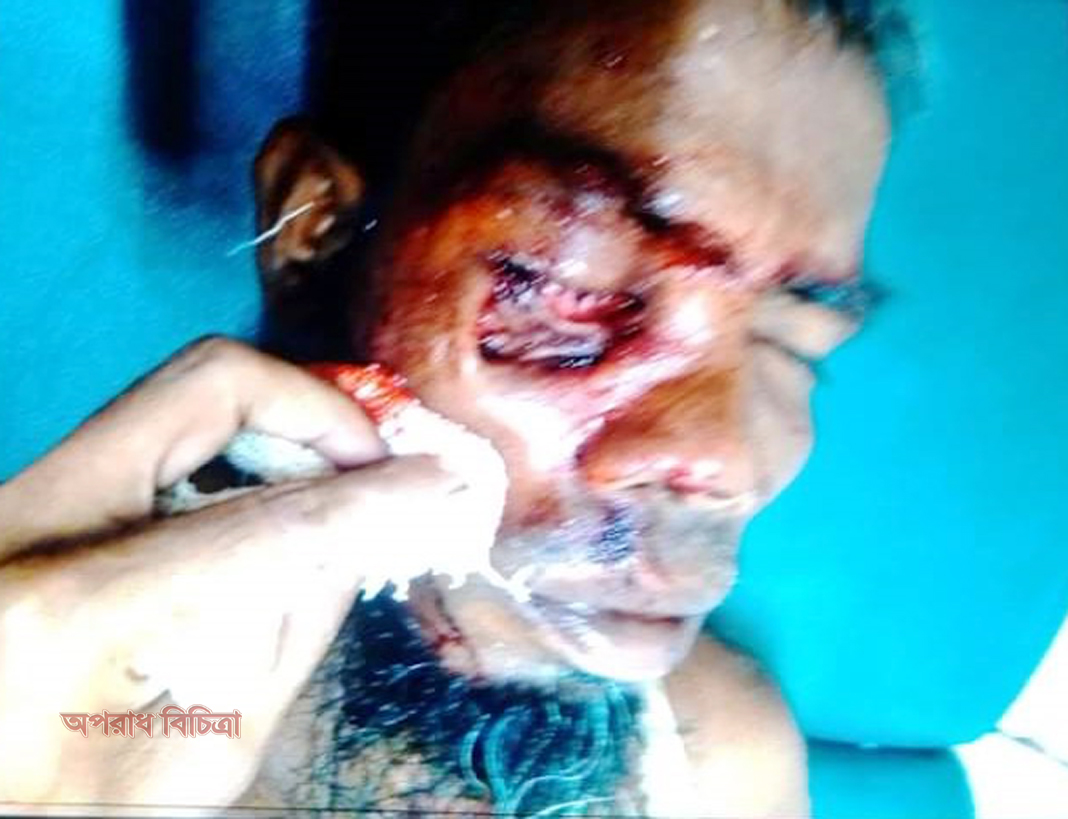 লালমনিরহাটে জমি নিয়ে বিরোধ প্রতিপক্ষের হামলায় ৫ জন হাসপাতালে