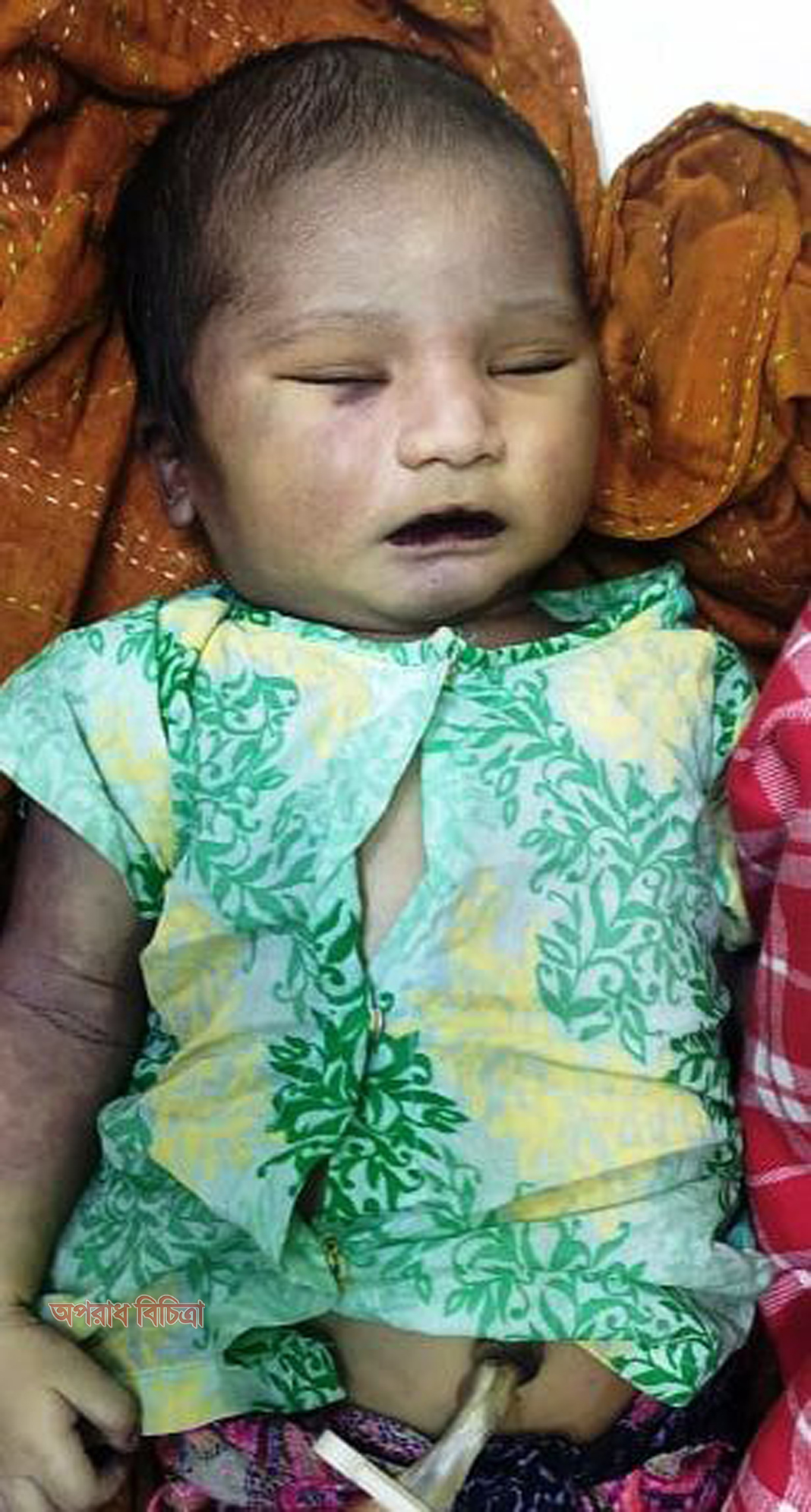 ঢাকা ইম্পেরিয়াল হাসপাতালে চিকিৎসকের অবহেলায় নবজাতকের মৃত্যু
