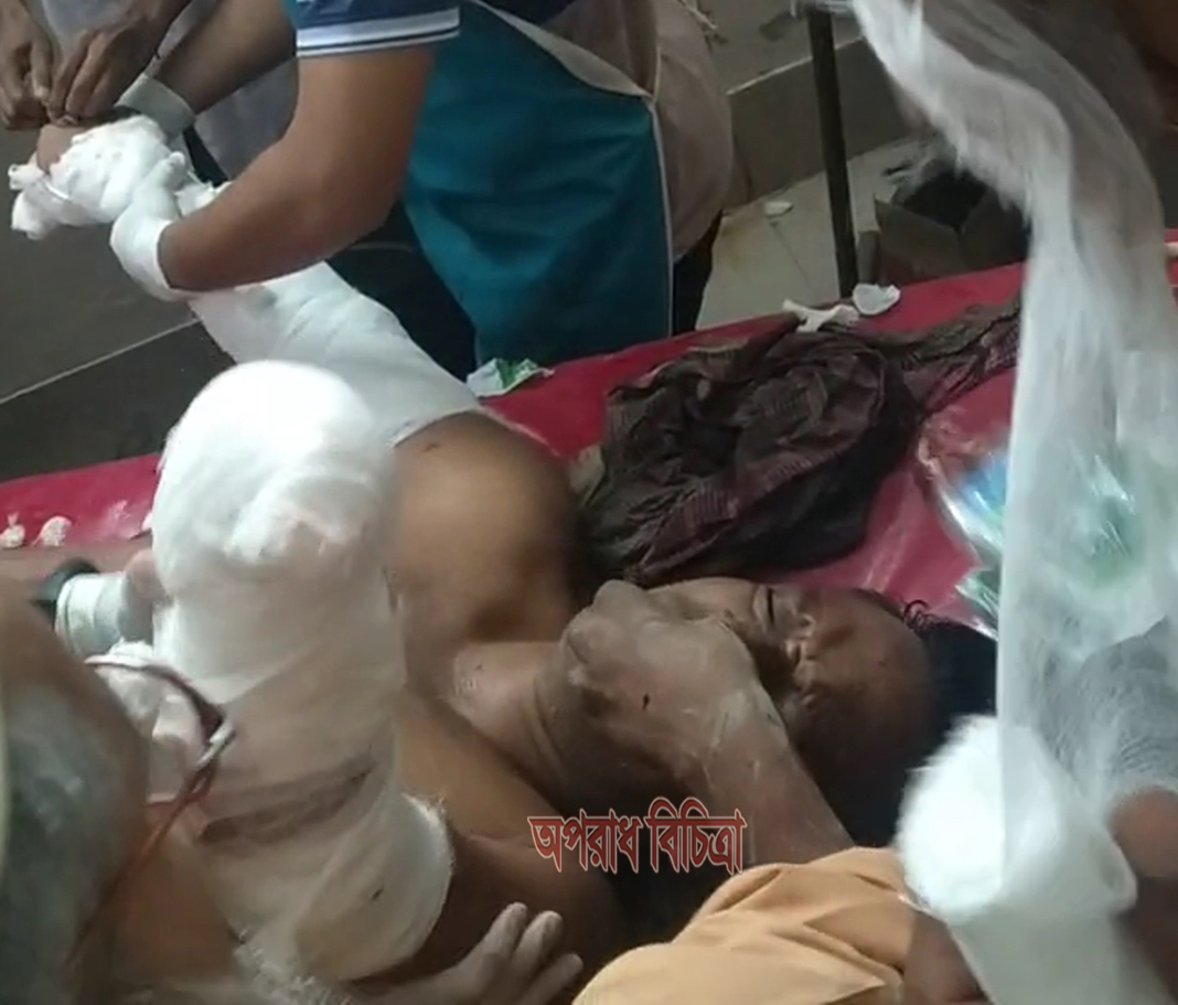 পটুয়াখালীর কলাপাড়ায় হাত কেটে নেয়া সেই শ্রমিকলীগ নেতার মৃত্যু