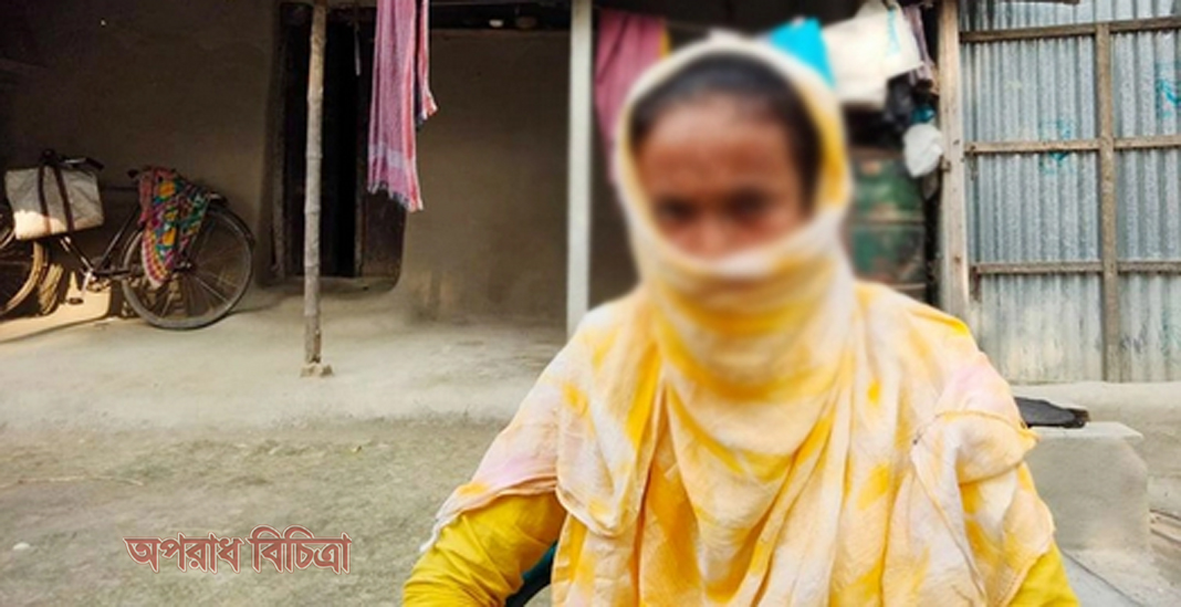 স্বামীর ছোড়া এসিডে নিঃশ্বাস নিতে কষ্ট হয়, বিচার দাবি
