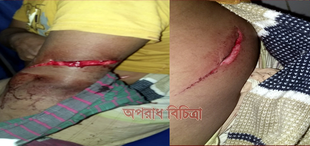 ওয়াজ মাহফিল নিয়ে বিরোধের জেরে প্রতিপক্ষকে কুপিয়ে জখম, থানায় মামলা