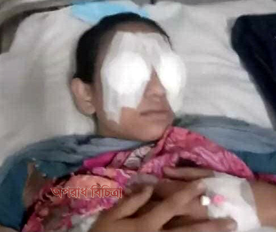 কালকিনিকে গৃহবধূর চোখ উপড়ে ফেলার চেষ্টা