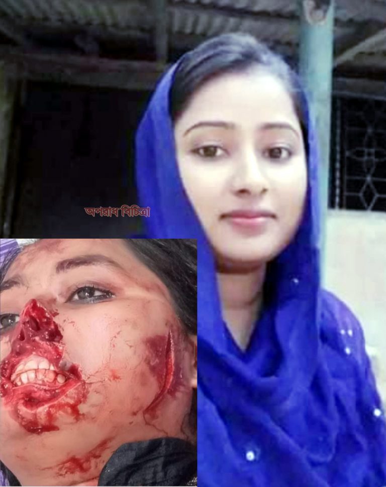 কক্সবাজার ঈদগাঁওতে গৃহবধু রুনাকে কুপিয়ে হত্যার চেষ্টাকারীদের রক্ষায় মহল বিশেষের তৎরত নিন্দা