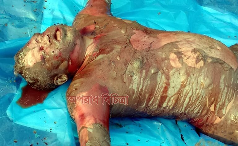 দুমকিতে অর্ধগলিত মরদেহ উদ্ধার