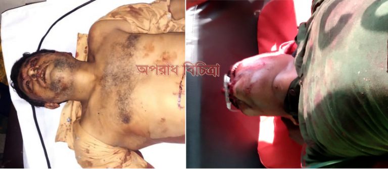 নোয়াখালীতে ইউপি নির্বাচন পূর্ব সহিংসতায় নিহত ২, আহত ৪