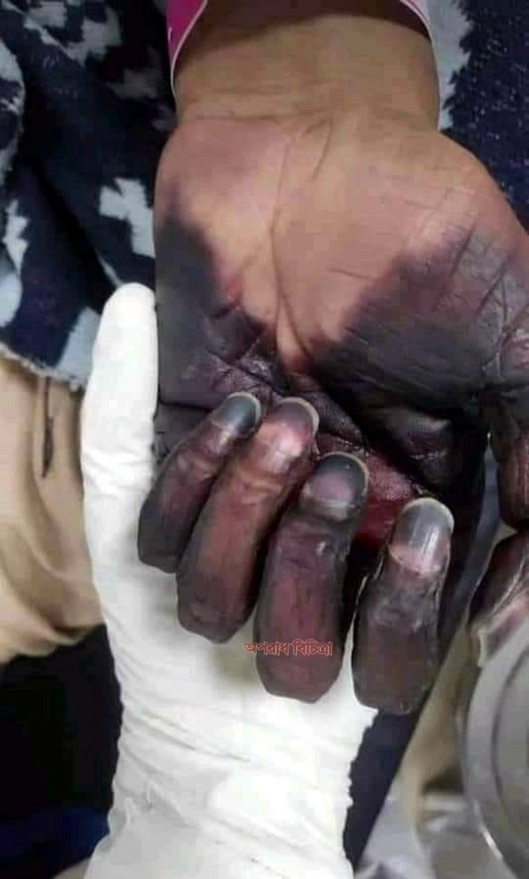 সবাই সাবধানে থাকবেন এবং নিজের পরিবারকেও সাবধানে রাখবেন