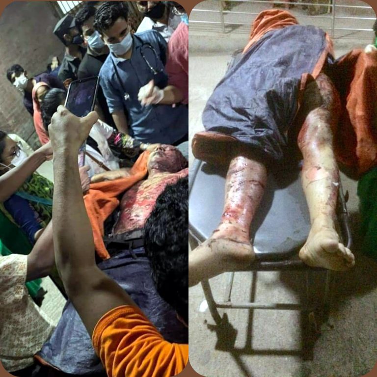 মগবাজারে ভয়াবহ বিস্ফোরণ: মৃতের সংখ্যা বেড়ে ৭