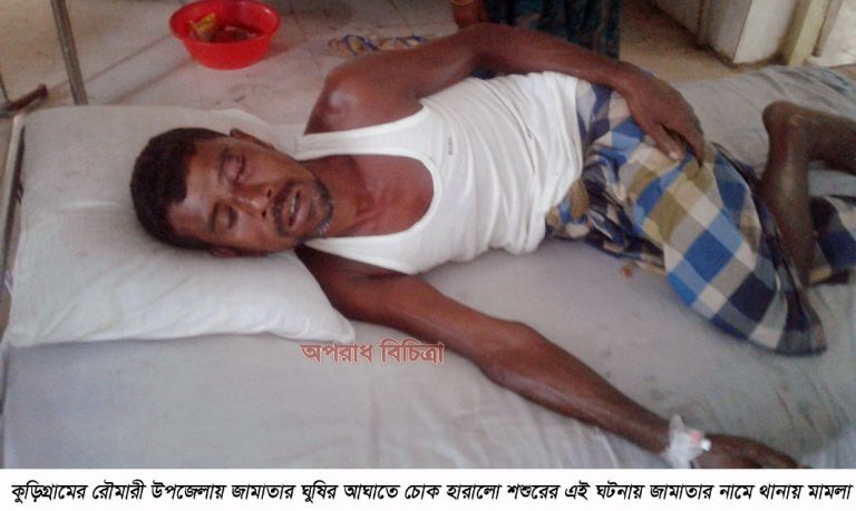 কুড়িগ্রামের রৌমারী জামাতার ঘুষির আঘাতে চোখ হারালো শশুর জামাতার বিরুদ্ধে থানা মামলা
