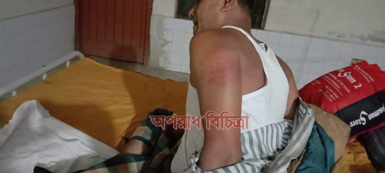 দুমকিতে আওয়ামীলীগ কর্মীকেপিটিয়ে রক্তাক্ত জখম